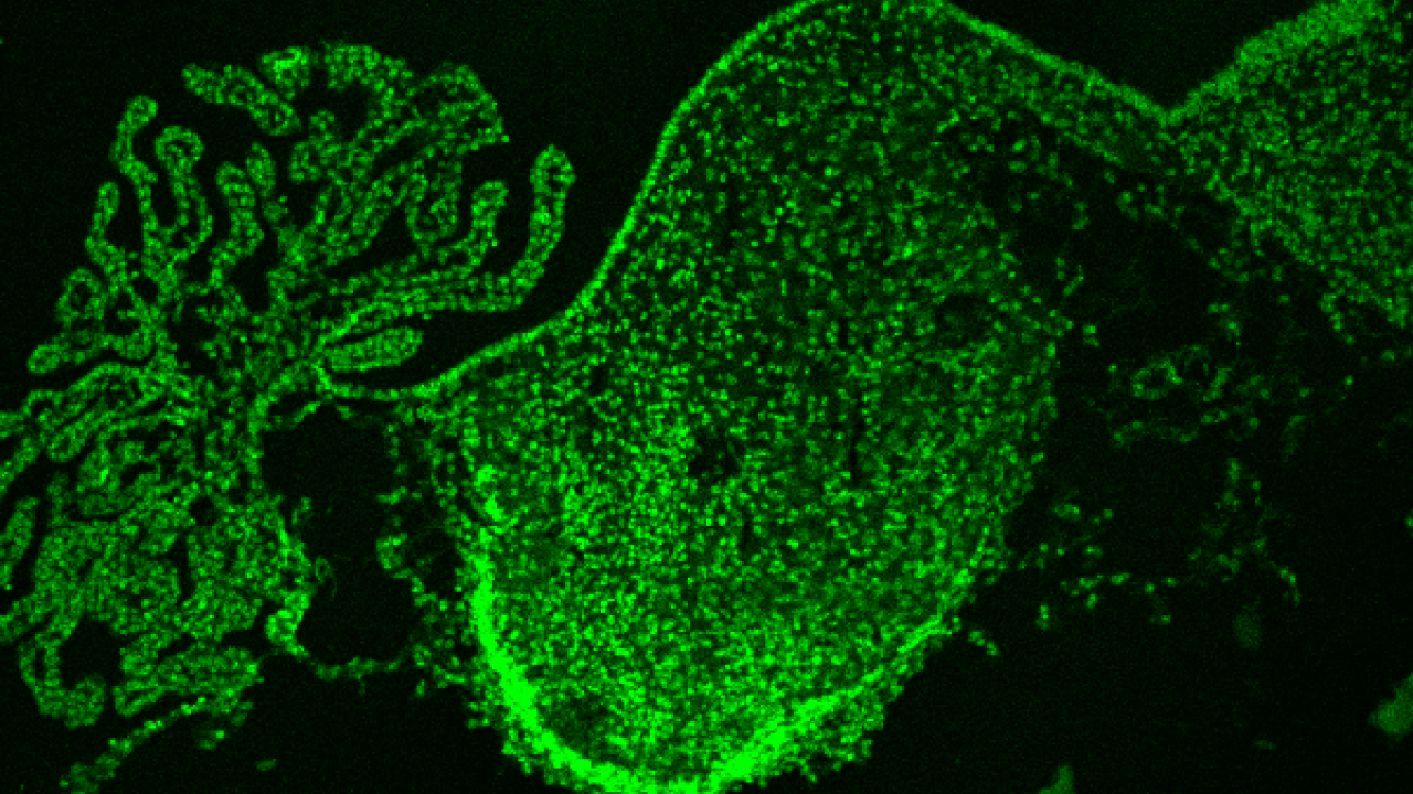 A c-Myc and N-Myc double knockout P6 cerebellum, stained in green for the tumor suppressor p27KIP1