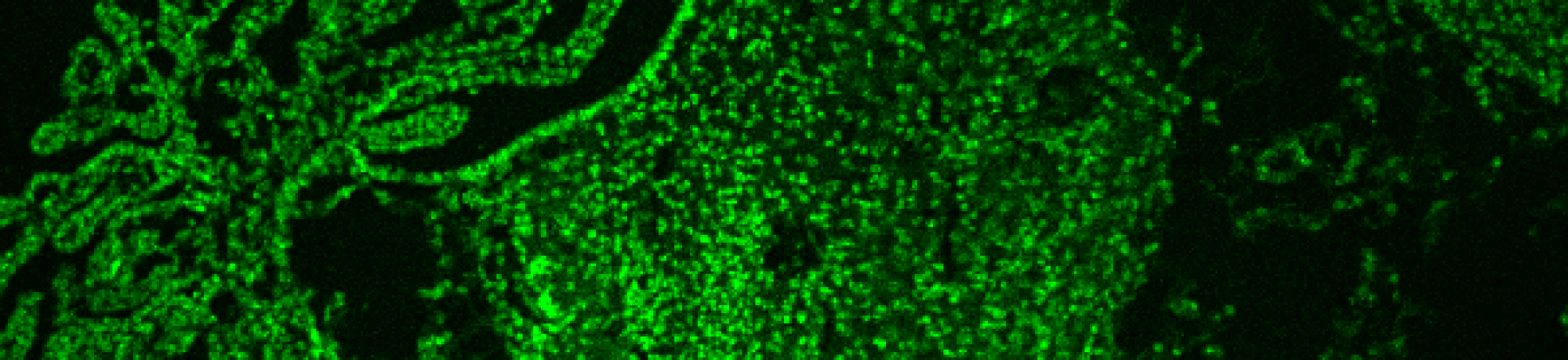 A c-Myc and N-Myc double knockout P6 cerebellum, stained in green for the tumor suppressor p27KIP1